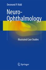 50 Illustrated Cases in Neuro-ophthalmology Cover des Buches 50 Illustrated Cases in Neuro-ophthalmology (ISBN: 9781447124092)