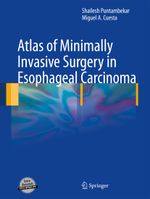 Atlas of Minimally Invasive Surgery in Esophageal Carcinoma Cover des Buches Atlas of Minimally Invasive Surgery in Esophageal Carcinoma (ISBN: 9781447160083)