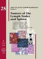 Tumors of the Lymph Nodes and Spleen (AFIP Atlas of Tumor Pathology, Series 4,) Cover des Buches Tumors of the Lymph Nodes and Spleen (AFIP Atlas of Tumor Pathology, Series 4,) (ISBN: 9781933477381)