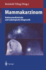 Mammakarzinom Cover des Buches Mammakarzinom (ISBN: 9783642804397)