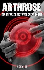 Arthrose: Die unterschätzte Volkskrankheit Cover des Buches Arthrose: Die unterschätzte Volkskrankheit (ISBN: B07PJM7TYN)
