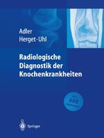 Radiologische Diagnostik der Knochenkrankheiten Cover des Buches Radiologische Diagnostik der Knochenkrankheiten (ISBN: 9783662096611)