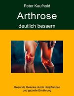 Arthrose deutlich bessern Cover des Buches Arthrose deutlich bessern (ISBN: 9783759733085)